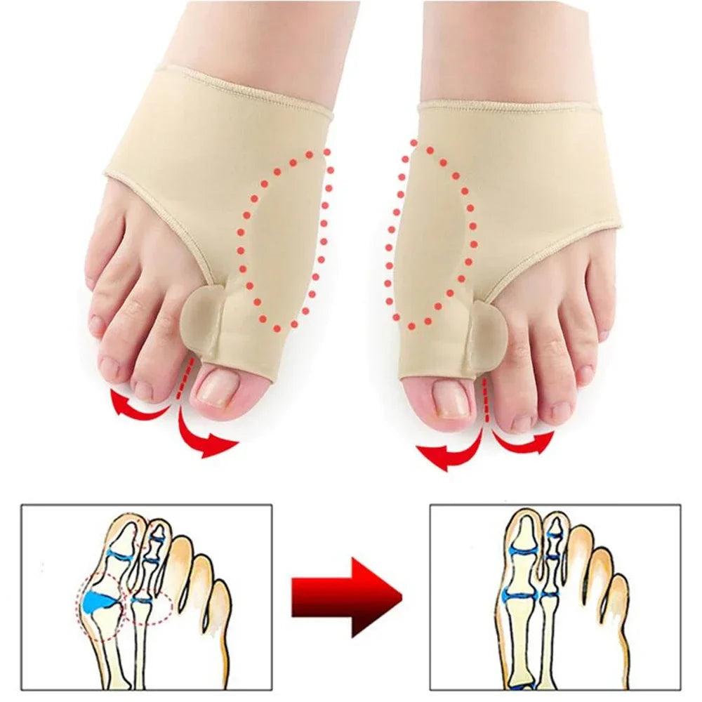 Corrector de Juanetes - Pack 4 uds